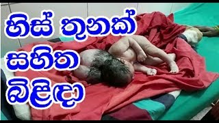 හිස් තුනක් සහිතව උපන් අරුම පුදුම බිළිඳා