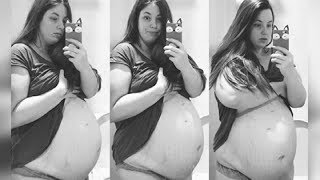 Mom’s Pregnant Belly Never Stops Growing Then Doctors Panic And Ask Her To Sacrifice Her Babies