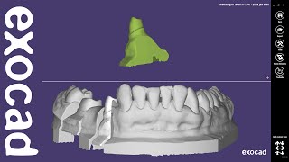 exocad Quick Guide: Extra Jaw Scan