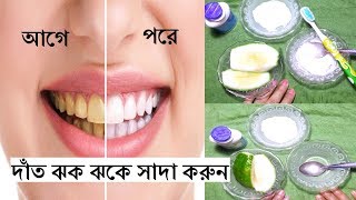 মাত্র ১ দিনে পরিষ্কার করুন দাঁতের হলদে ও কালো দাগ আর দাঁতকে করুন ঝকঝকে সাদা // Bd Shajghor