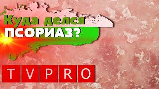 ВРАЧИ В ШОКЕ!!! ВЫЛЕЧИЛА ПСОРИАЗ и ГАЙМОРИТ!/ ОТЗЫВЫ