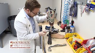 FourrouxProsthetics Provides Amputees a Prosthesis in One Days Time!