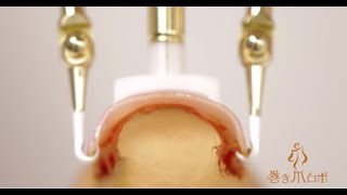 巻き爪矯正は自分で！痛い原因を元から解消する巻き爪の治し方【Aタイプ】