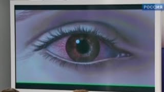 Конъюнктивит - симптомы и лечение у детей и взрослых