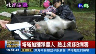 獼猴帶疱疹B病毒 致死率7成