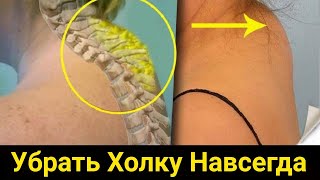 Холка, шишка на шее - как избавиться.