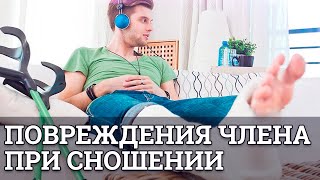 Повреждение члена при сношении || Юрий Прокопенко 18+
