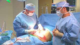 Miami Plastic Surgery - Tummy Tuck (Abdominoplasty) Surgery with Dr. Michael Kelly