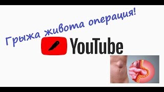 Грыжа белой линии живота, оперативное лечение . Детская хирургия. Операция от первого лица.