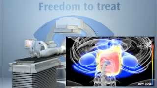 Лечение с использованием линейного ускорителя Elekta Synergy®