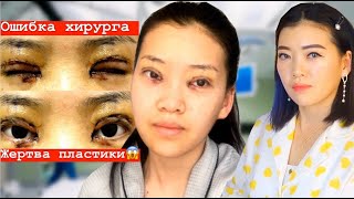 Меня изуродовал хирург?Повторная пластическая операция в Корее?Слабонервным не смотреть|NikyMacAleen