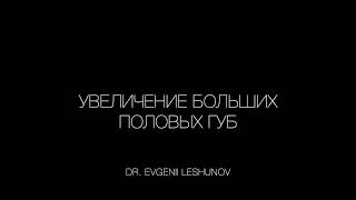 Увеличение больших половых губ с помощью гелей гиалуроновой кислоты