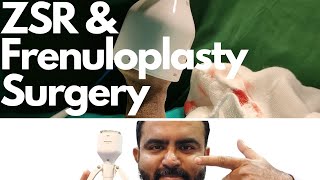Frenuloplasty and ZSR Circumcision by Dr.Sachin Kuber +919370275336/+919370240098