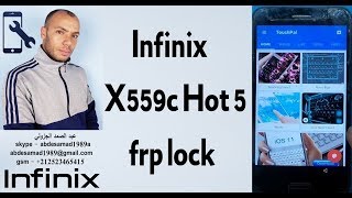 Infinix X559c Hot 5 frp lock google account bypass frp reset