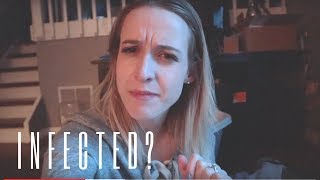 An amputation infection update...