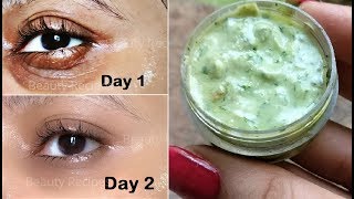 in 5 Days Remove Under Eye Wrinkles, Dark Circles, Under Eye Bags with Potato Eye Mask
