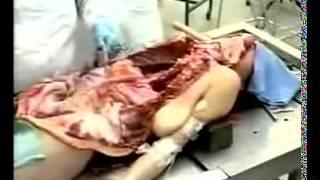 Autopsy part 1 of 2