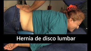 Hernia de disco L4-L5 y L5-S1.  Hernia lumbar.