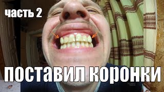 Зубные протезы (часть 2) Одели коронки из металлокерамики. Реальная история