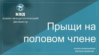 Прыщи на половом члене