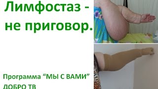 Лимфостаз не приговор (Всё о лечении лимфедемы). Программа "МЫ С ВАМИ" ДОБРО ТВ