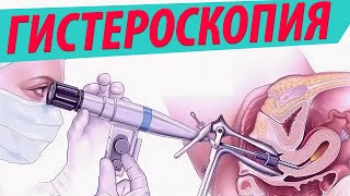 Гистероскопия: подготовка, проведение, реабилитация