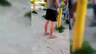 жесть 18+ поломал руки