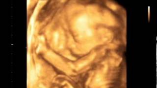 3D/4D УЗИ 21 неделя (3D/4D Ultrasound scan baby 21 Weeks)