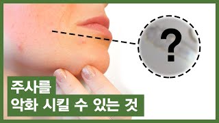 #19 주사(주사비,주사피부염), 여드름은 이것때문에 더 악화될수 있습니다.