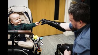 Amputee bonds with son thanks to 3D printed hand