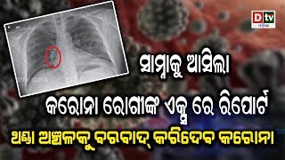ସାମ୍ନା କୁ ଆସିଲା କରୋନା ରୋଗୀଙ୍କ ଏକ୍ସ ରେ ରିପୋର୍ଟ | Odia news live updates #dtvodia