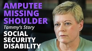 Amputee Missing Right Shoulder Talks about Social Security Disability | Tammy's Story