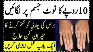 Dagh Dahbe door Karne ka Ilaj | Jisam se Nishan Khatam karne ka Ilaj