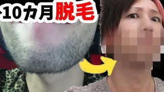 【永久脱毛】メンズリゼでレーザー脱毛したらこうなる！