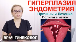 Гиперпластические процессы эндометрия, полипы эндометрия, гиперплазия эндометрия. Полипы в матке