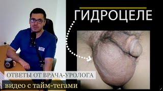 Гидроцеле ответы на вопросы пациентов от врача-уролога