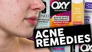 4 BEST Acne Treatments That Actually Work (LISTED)