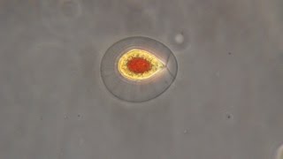 Haematococcus pluvialis, the green algae that turn red.