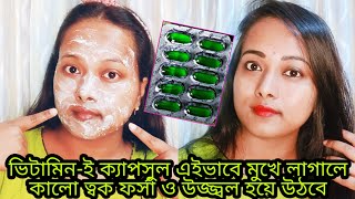 |ভিটামিন-ই ক্যাপসুল এইভাবে মুখে লাগালে কালো ত্বক ফর্সা ও উজ্জ্বল উঠবে|Vitamin E for Skin Whitening|