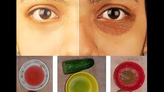 চোখের নিচে কালো দাগ দূর করার উপায় | How to remove dark circle | Beauty Tips House
