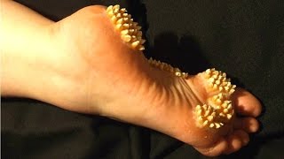 10 Disgusting Medical Treatments That Could Save Your Life