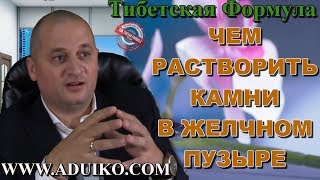 Камни в желчном пузыре - чем растворить? Безопасность препаратов Тибетской Формулы