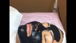 Как Удалить Угри! [Угри Черные Точки]