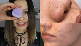Szczoteczka do twarzy FOREO LUNA go - hit, czy kit?
