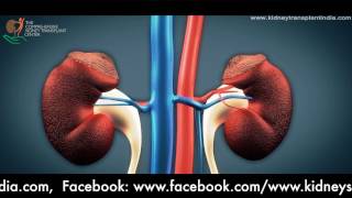 Kidney Transplantation: Animation of Surgical steps as performed by Dr. Priyadarshi Ranjan