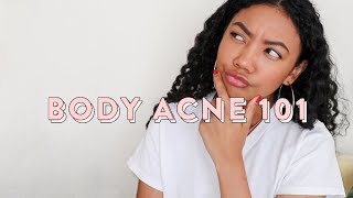 6 REASONS WHY YOU HAVE BODY ACNE!