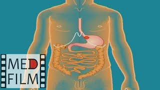 Система пищеварения у детей © digestive system in children
