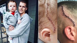 Dad Gets Tattoo on Head to Match 1-Year-Old Son's Scar