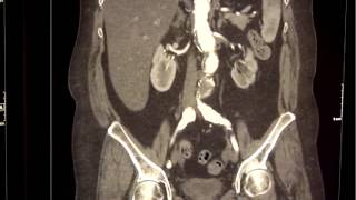 Women and Urological Problems