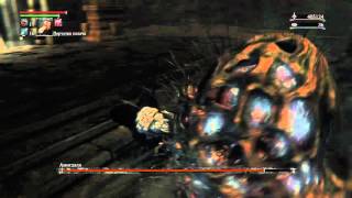 Bloodborne Амигдала изи 3. Проклятая чаша нижнего Лорана.